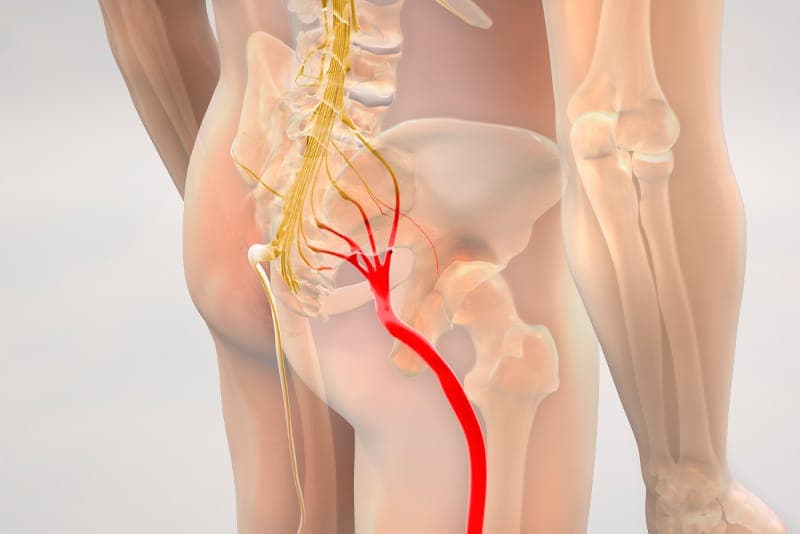 A person holding the back of their leg, a sign of sciatica